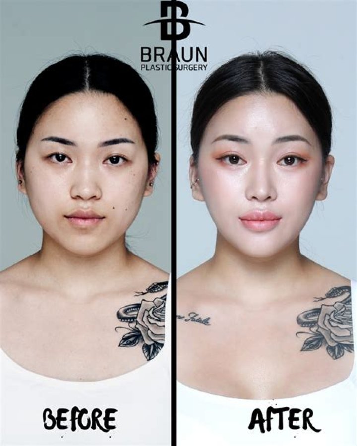 Sweet Topic Plasticurgery: A Comprehensive Guide to Understanding Cosmetic Surgery