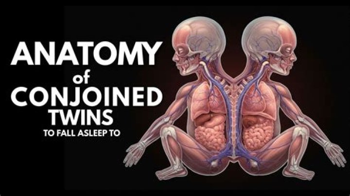 Exploring the Fascinating World of Twins One Body