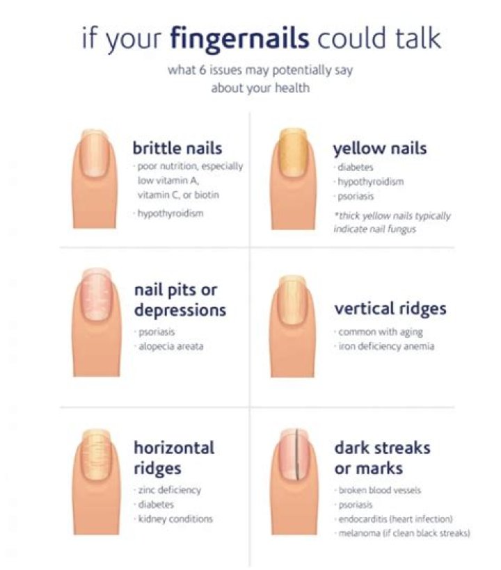 Vertical Lines in Nails Thyroid: Understanding the Connection