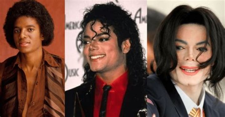 Unveiling the Truth About Michael Jackson's Vitiligo: A Comprehensive Guide