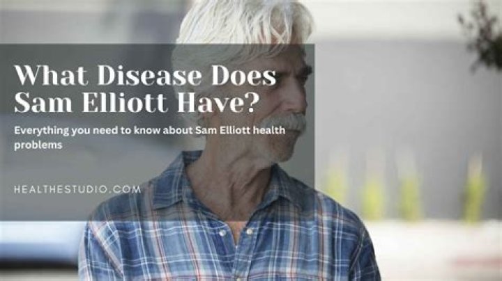 What Disease Does Sam Elliott Have? Unveiling the Health Truth Behind the Iconic Actor