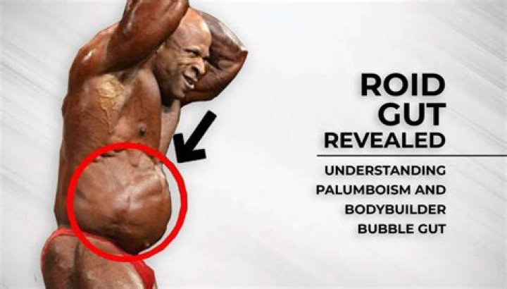 What is Bubble Guts: A Comprehensive Guide to Understanding and Managing This Uncomfortable Condition