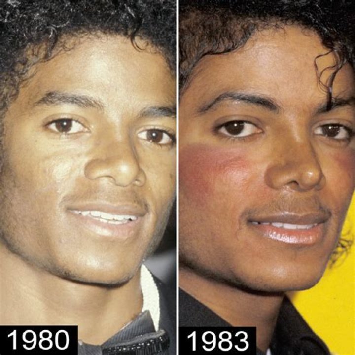 Why Did Michael Jackson's Skin Color Change? Unveiling the Truth Behind the Transformation