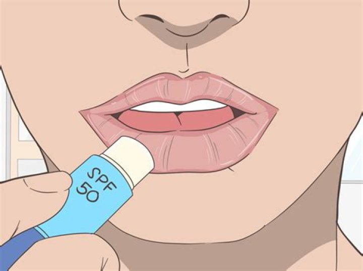 Why Does Chapstick Burn? A Comprehensive Guide to Understanding the Phenomenon